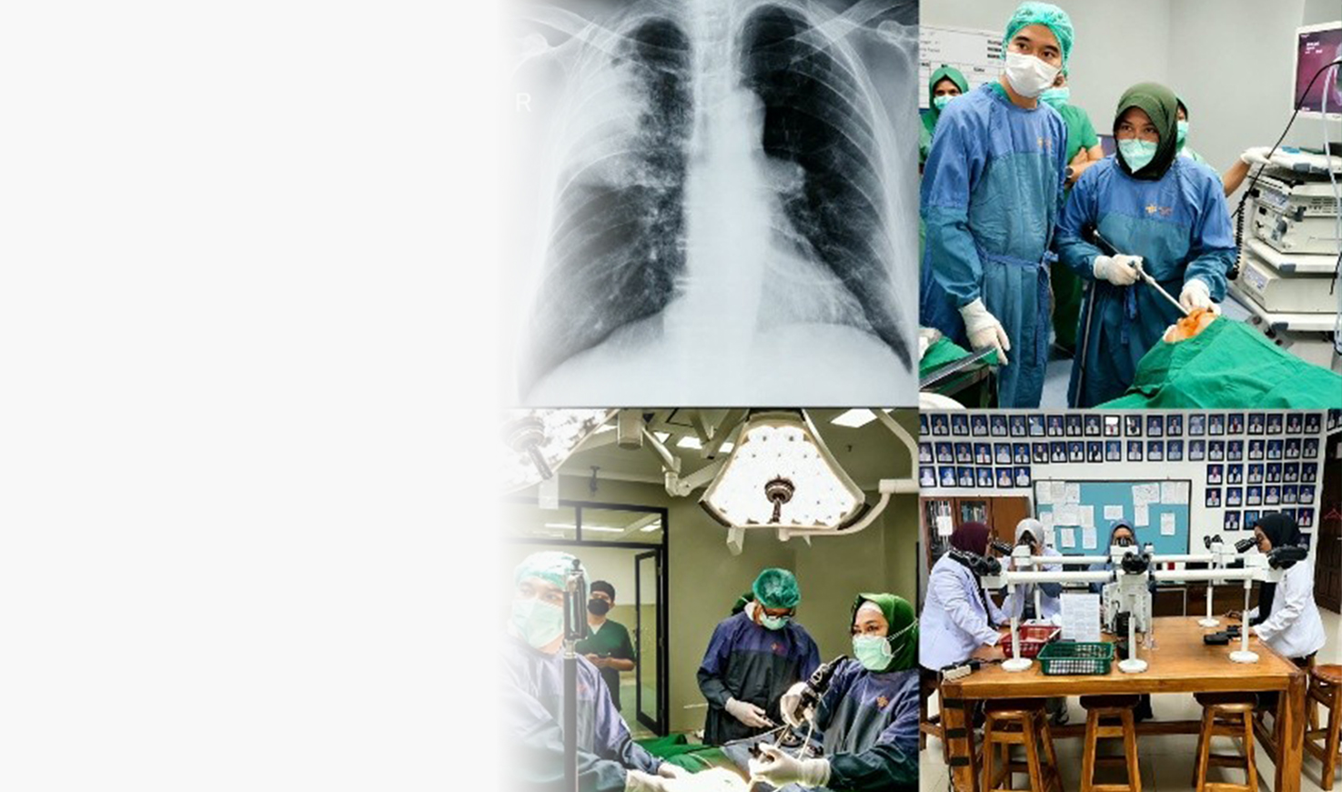 Subspesialis Pulmonologi dan Kedokteran Respirasi